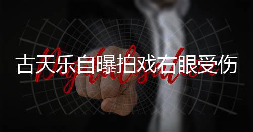 曝拍乐自针后缝8古天戏右伤 伤势眼受已经痊愈